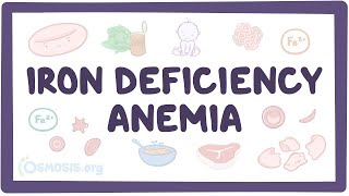 Iron deficiency anemia  an Osmosis Preview [upl. by Kwei]