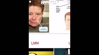 Cranial Nerves  Part 8 [upl. by Derrik]