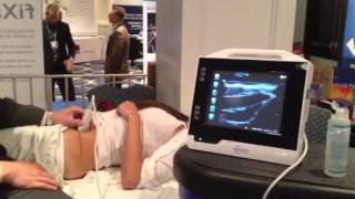 Ultrasound Guided Illeoingunal Nerve Block [upl. by Adalard231]