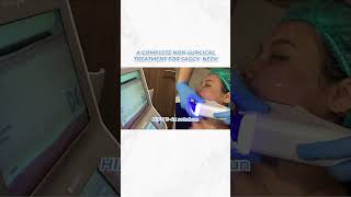 A COMPLETE NON SURGICAL TREATMENT FOR SAGGY NECK treatments [upl. by Ayimat]