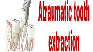 Use of a luxator to extract the root stumps how to luxate and extract a tooth [upl. by Ahsielat]