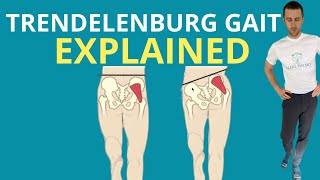 Trendelenburg Gait Explained [upl. by Felske694]