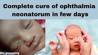 ophthalmia neonatorum treat with homeopathy conjuctivitis of newborn treatment [upl. by Evoy]