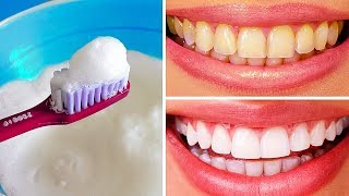 10 Natural Ways to Whiten Teeth at Home [upl. by Akceber]