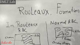 Rouleaux formation [upl. by Asnarepse]