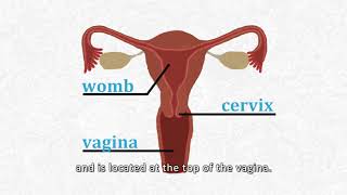 Cervical Cancer Screening [upl. by Assylla]