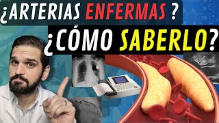 INTERESANTE¡ Exámenes para saber SI TENGO las ARTERIAS del corazón ENFERMAS 😲 [upl. by Mackenie]