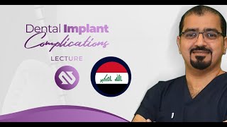 Dental Implant Complications by Dr Walaa AlMola [upl. by Bremser]