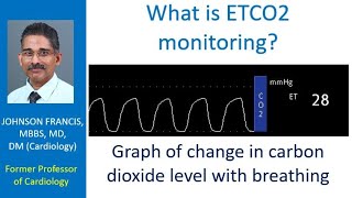 What is ETCO2 monitoring [upl. by Areyk]