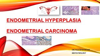 Endometrial Carcinoma amp Endometrial Hyperplasia [upl. by Nehtanhoj]