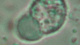 Chlamydiosis Chlamydia trachomatis [upl. by Lipcombe127]