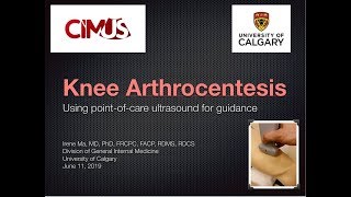 US Guided Knee Arthrocentesis [upl. by Kimberlyn367]