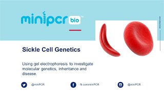 Live Demo Sickle Cell Genetics [upl. by Tillion]