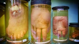 Bumfights Creators Attempted to Smuggle Baby Body Parts [upl. by Lrigybab957]