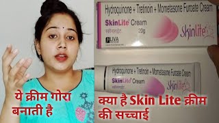 अब skin Lite लगाने से पहले 100 बार सोचेंगेSkin Lite Cream Review [upl. by Beshore]