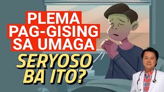 Plema Pag Gising sa Umaga Seryoso Ba Ito  By Doc Willie Ong [upl. by Ahsita269]