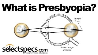 What is Presbyopia With SelectSpecscom [upl. by Coltson]