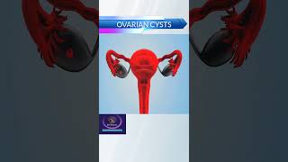 Ovarian Cysts Short View shorts [upl. by Basir]