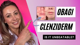 Obagi CLENZIderm MD System  UNBEATABLE ACNE RESULTS [upl. by Ihsorih289]