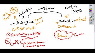 Bronchiectasis شرح كامل [upl. by Yerocaj]