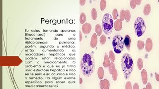 Sporanox para tratar Histoplamose Pulmonar aumenta os marcadores Hepáticos  Qual exame fazer [upl. by Idham]