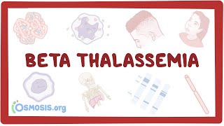 Betathalassemia  causes symptoms diagnosis treatment pathology [upl. by Raymund236]