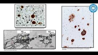 Glymphatic system and associations with diseases Students Lectorium [upl. by Alexandro]