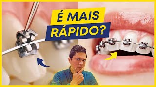 COMO FUNCIONA O APARELHO AUTOLIGADO É VERDADE QUE É MAIS RÁPIDO [upl. by Malsi]