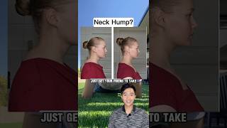 Fix Your Neck Hump 😳 Physio Explains [upl. by Annayhs796]