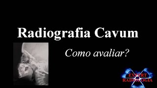 Radiografia Cavum como avaliar [upl. by Natye]