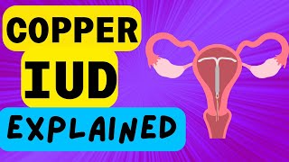 COPPER IUD EXPLAINED  INTRAUTERINE DEVICE  WHAT IS IT AND HOW IT WORKS [upl. by Enirehtac442]