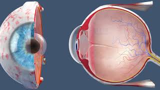 Cataract Surgery  Inside the OR [upl. by Nealon]