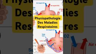 Physiopathologie Maladies Respiratoires pneumologie bronchite asthme fibrosepulmonaire poumon [upl. by Haland730]