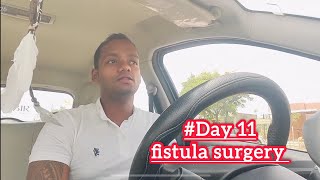 fistula surgery Day 11  fistula surgery recovery time  fissure kaise thik kare fistulainano [upl. by Panaggio44]