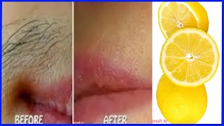 Unwanted hair removal for women naturally with lemon remedy  face hair removal for women at home [upl. by Zeugirdor]