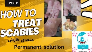 How to treat scabiespermanent solutionskin contagious infection ‎skinhealthvitality5959 [upl. by Arrad]