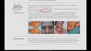 Polymyositis  Dermatomyositis  Musculoskeletal  28  First Aid USMLE in UrduHindi [upl. by Odlabu269]