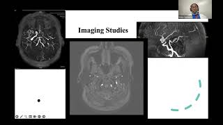 Sub Intern Case Presentations November 6th 2024 [upl. by Ecinerev]