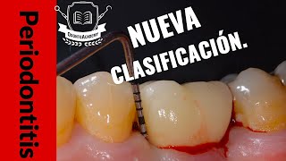 NUEVA CLASIFICACIÓN PERIODONTAL  CÓMO SE CLASIFICA LA PERIODONTITIS Actualización periodoncia [upl. by Aden]