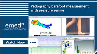 emed Pedography barefoot measurement with pressure sensor  novelde [upl. by Suirad411]