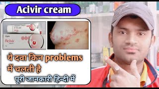 Acivir cream use benefits and Side effects full review in hindi [upl. by Drummond]