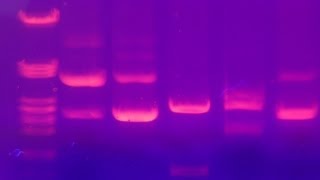 Agarose Gel Electrophoresis  Amrita University [upl. by Deron]