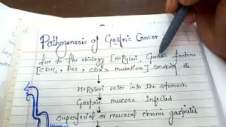 pathogenesis of gastric cancer NGMedicals [upl. by Erdnaet]