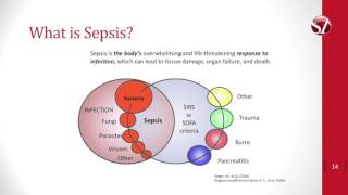 Nurses Suspect Sepsis Educational Video [upl. by El880]