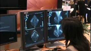 Hologic Unveils the Future of Breast Tomosynthesis [upl. by Cut]