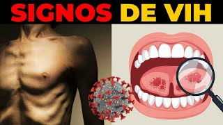 📢5 SÍNTOMAS DE QUE ESTÁS INFECTADO CON VIH [upl. by Aldredge]