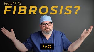 What Can You Do To Prevent FIBROSIS After Liposuction [upl. by Tarazi]