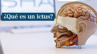 ¿Qué es un ictus [upl. by Neelcaj]