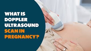 What is Doppler Ultrasound scan in Pregnancy pregancy pregnancyscan doppler ultrasoundscan [upl. by Burrow]