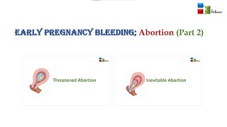 EARLY PREGNANCY BLEEDING THREATEND ABORTION INEVITABLE ABORTION PART 2 [upl. by Dyal]